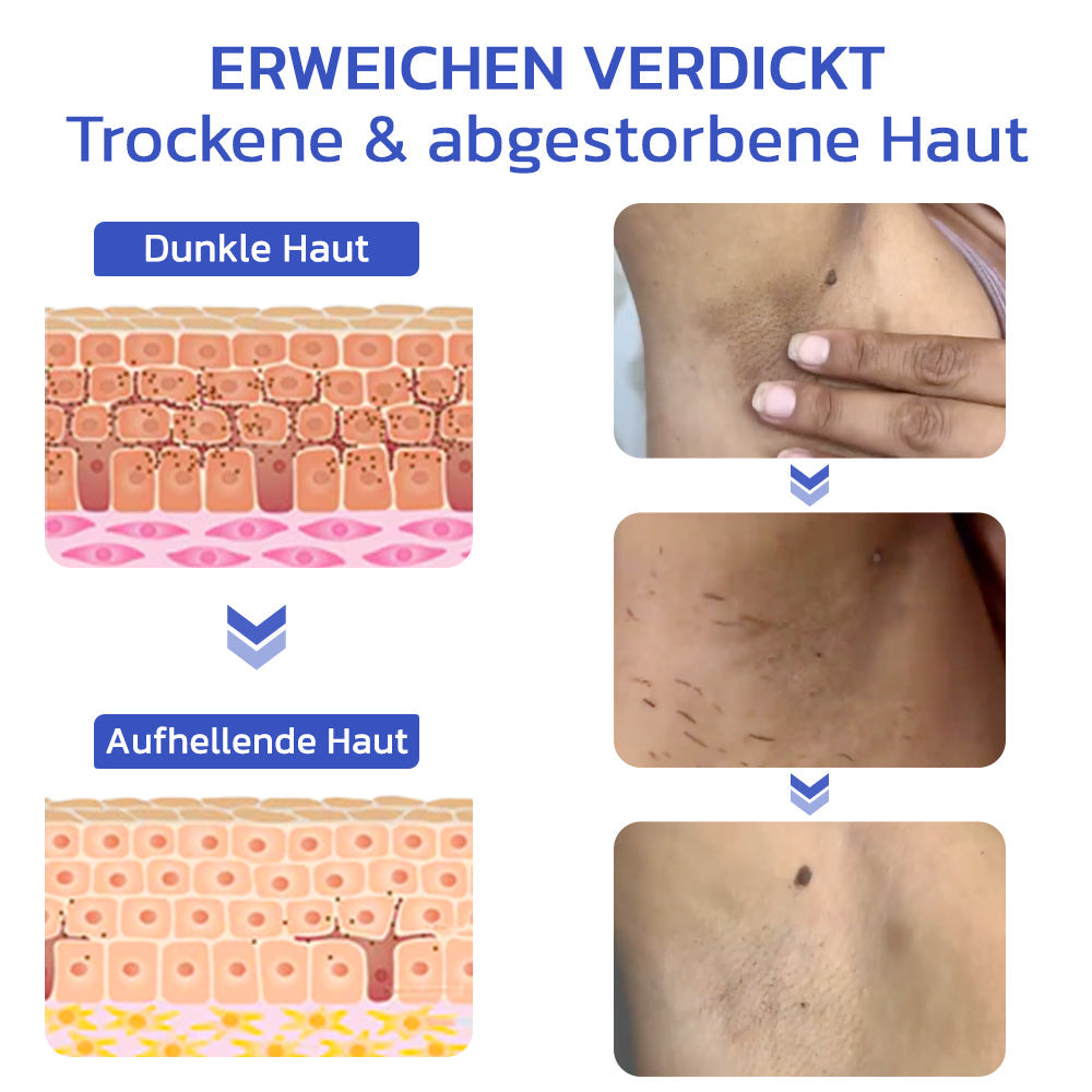 flysmus™ IvoryGlow Körper-Peeling-Gel mit Nicotinamid