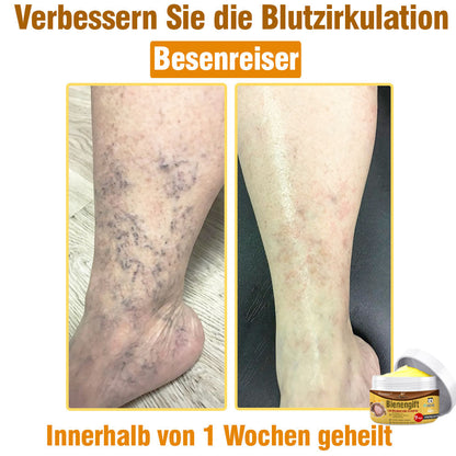 ⛑️ flysmus™ Bienengift Umfassende Creme 🇩🇪 Dermatologe empfohlen