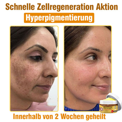 ⛑️ flysmus™ Bienengift Umfassende Creme 🇩🇪 Dermatologe empfohlen