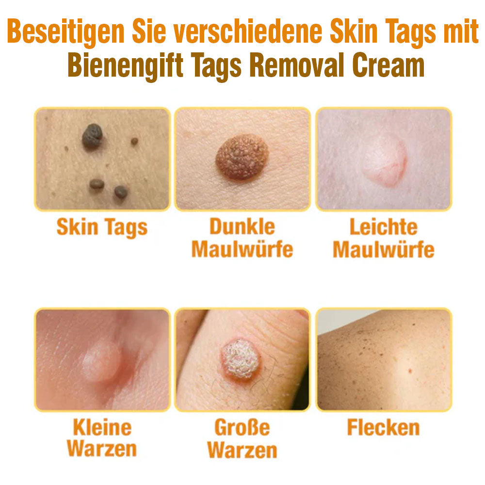 flysmus™ Creme zur Entfernung von Bienengift-Tags 🌿 Hergestellt in Deutschland 🇩🇪 DDG Recommend