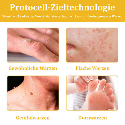 🐝Furzero™ Bienengift-Therapie-Spray（✅Dermatest-Zertifizierung）