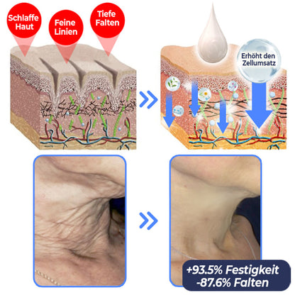 🇩🇪 flysmus™ Erweiterte straffende & faltenreduzierende Lotion