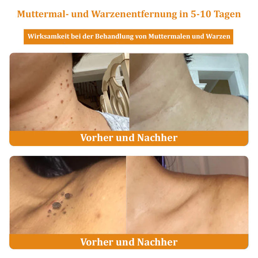 🐝Furzero™ Bienengift-Therapie-Spray（✅Dermatest-Zertifizierung）