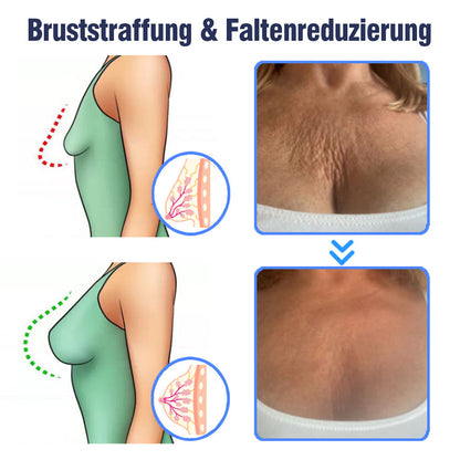 flysmus™ Erweiterte straffende & faltenreduzierende Lotion (Copy)