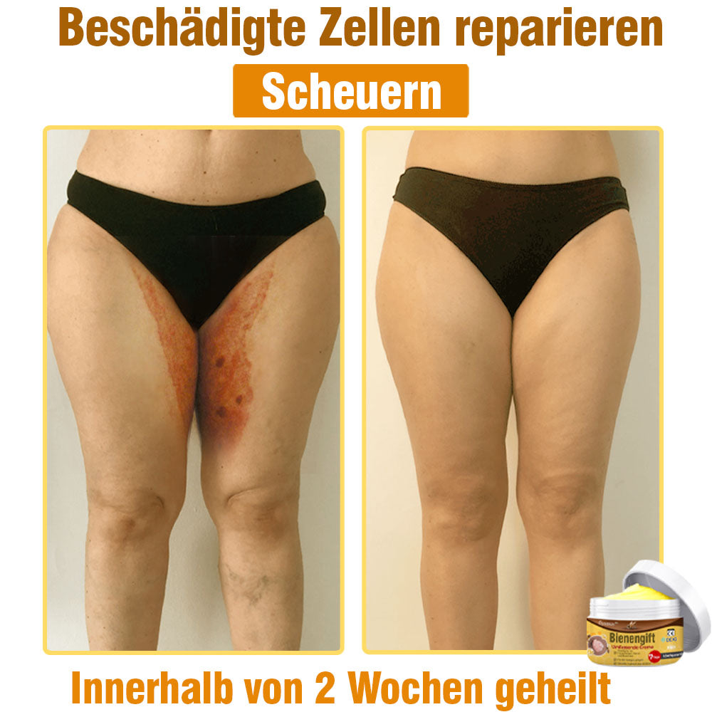 ⛑️ flysmus™ Bienengift Umfassende Creme 🇩🇪 Dermatologe empfohlen