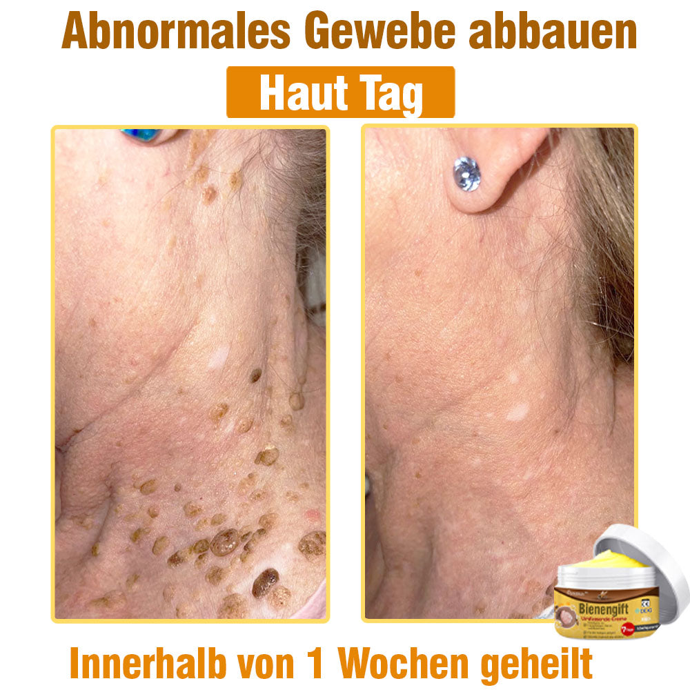 ⛑️ flysmus™ Bienengift Umfassende Creme 🇩🇪 Dermatologe empfohlen