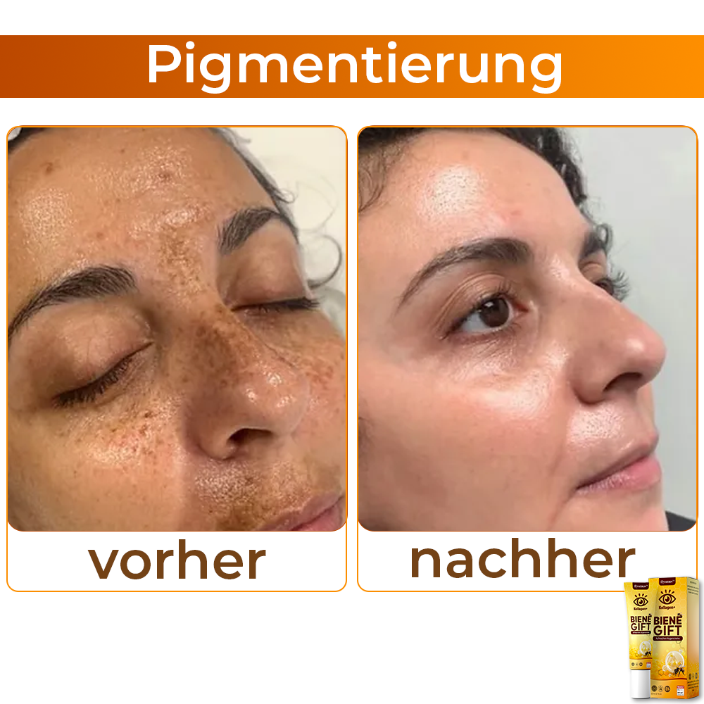 💖 flysmus™ Kollagen+ Bienengift Aufwachen Augencreme 🇩🇪 Vom Dermatologen genehmigt