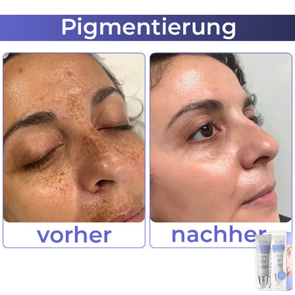 🩷 flysmus™ Kollagen+ Aufwachen Augencreme 🇩🇪 Vom Dermatologen genehmigt