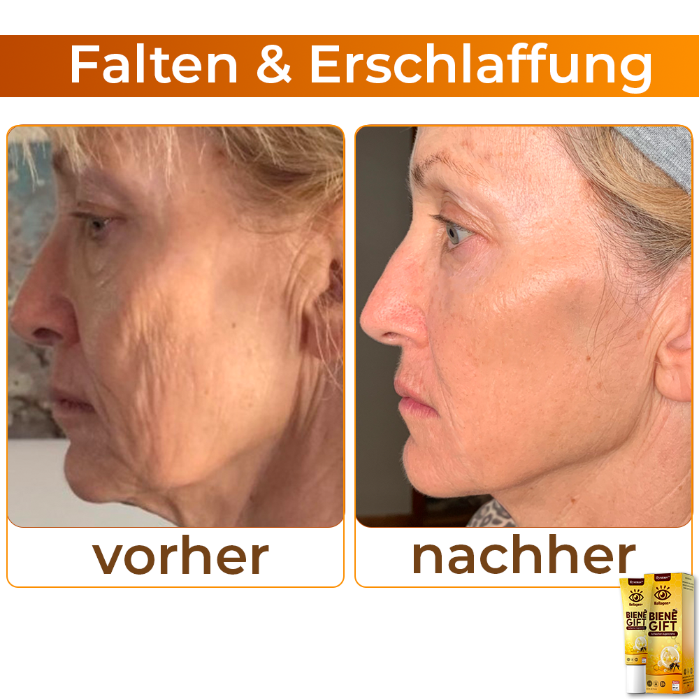 💞 flysmus™ Kollagen+ Bienengift Aufwachen Augencreme 🇩🇪 Dermatologe Empfohlen