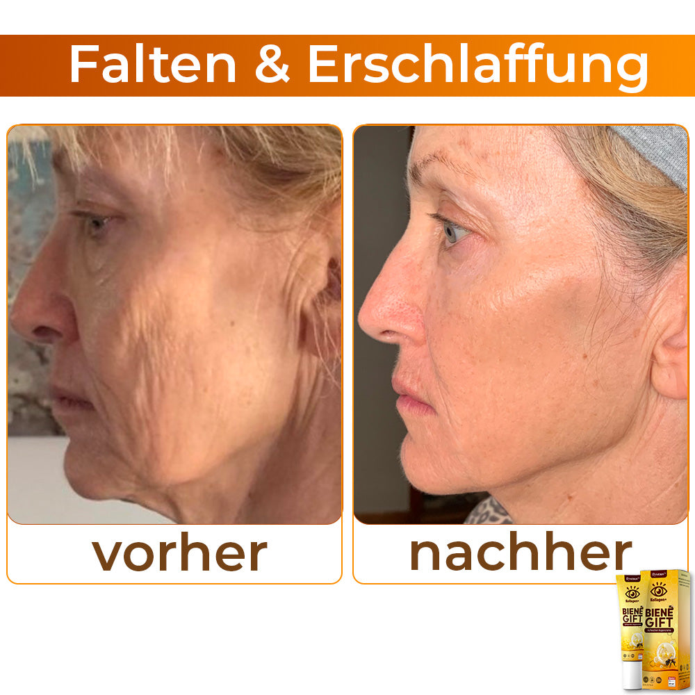 💖 flysmus™ Kollagen+ Bienengift Aufwachen Augencreme 🇩🇪 Vom Dermatologen genehmigt