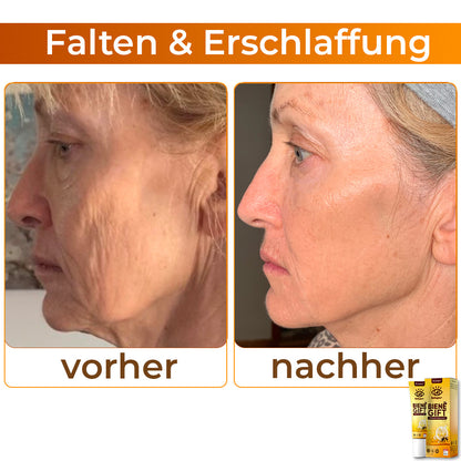 💕 flysmus™ Kollagen+ Bienengift Aufwachen Augencreme 🇩🇪 Vom Dermatologen genehmigt