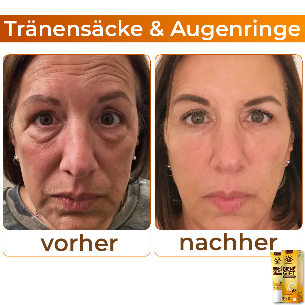 💞 flysmus™ Kollagen+ Bienengift Aufwachen Augencreme 🇩🇪 Dermatologe Empfohlen