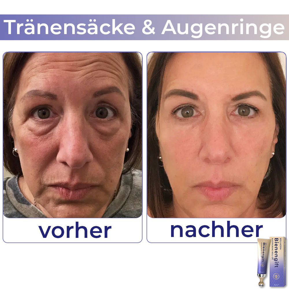 🐝 flysmus™ Kollagen+ Bienengift Augencreme Roll-on 🇩🇪 Vom Dermatologen genehmigt