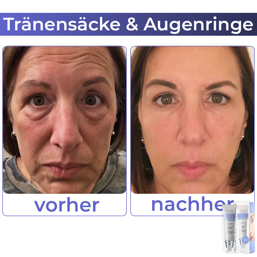 🩷 flysmus™ Kollagen+ Aufwachen Augencreme 🇩🇪 Vom Dermatologen genehmigt