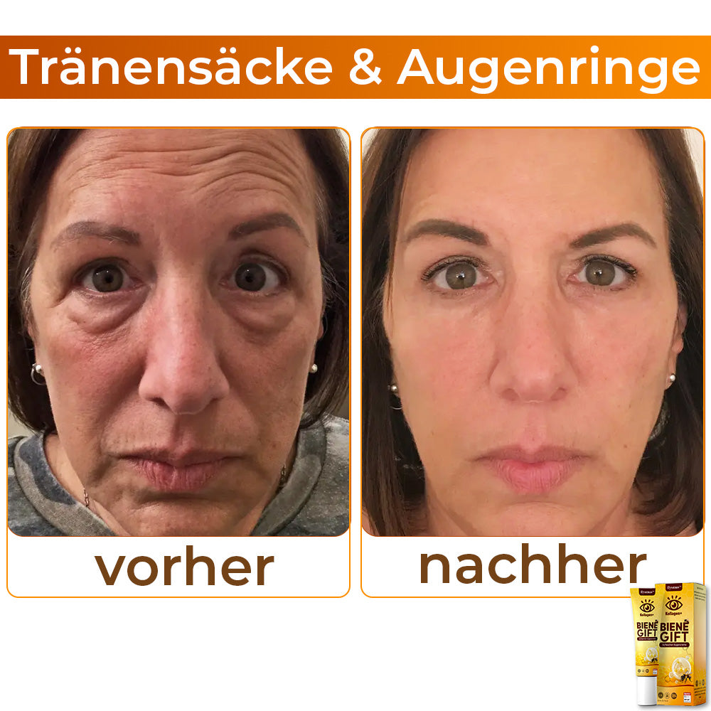 💖 flysmus™ Kollagen+ Bienengift Aufwachen Augencreme 🇩🇪 Vom Dermatologen genehmigt