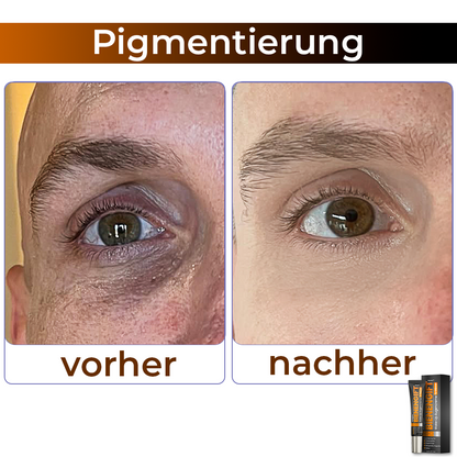 🎩 flysmus™ Kollagen+ Bienengift Wake-Up Augencreme für MÄNNER 🇩🇪 Vom Dermatologen genehmigt