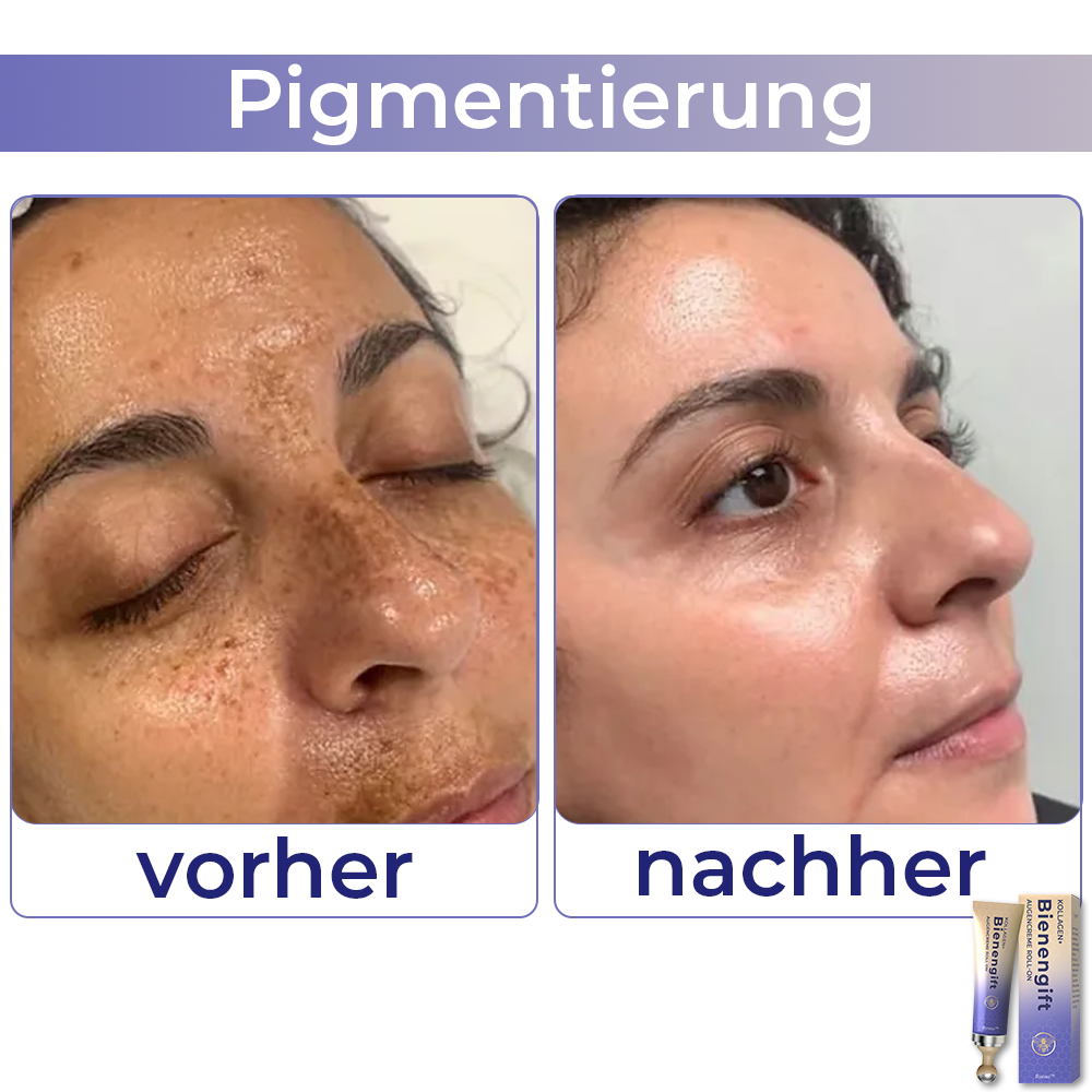 🐝 flysmus™ Kollagen+ Bienengift Augencreme Roll-on 🇩🇪 Vom Dermatologen genehmigt