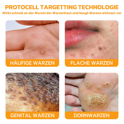 Furzero™ Bienengift Hautpflege-Pads (⚕️DDG empfohlen 🇩🇪)