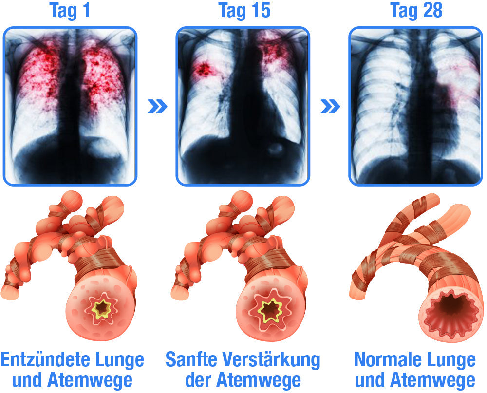 GFOUK™ BreathBliss Atemwege reinigendes Kräuterspray