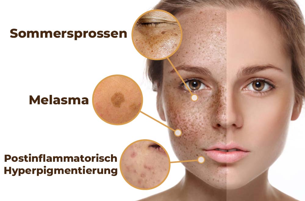 flysmus™ PeptideLuxe Melanin Verschwinden Serum