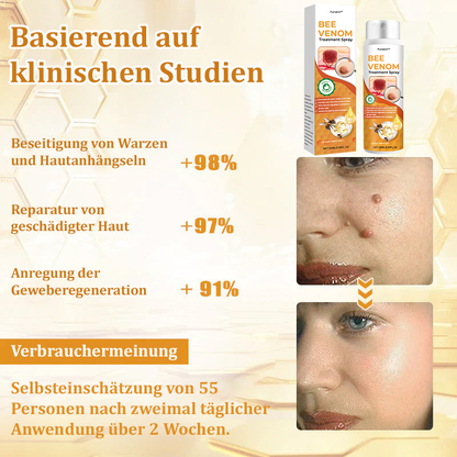 🐝Furzero™ Bienengift-Therapie-Spray（✅Dermatest-Zertifizierung）