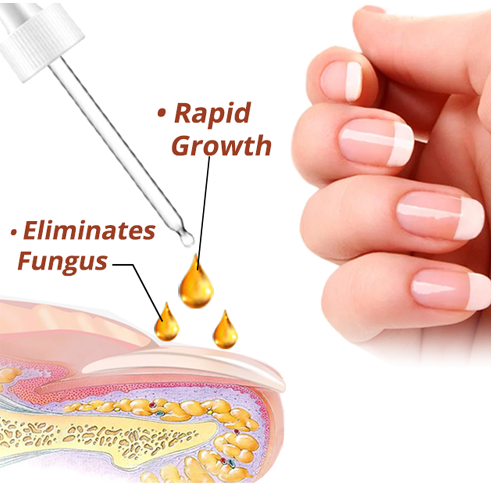 GFOUK™ 7 Tage Serum für Nagelwachstum und -stärkung