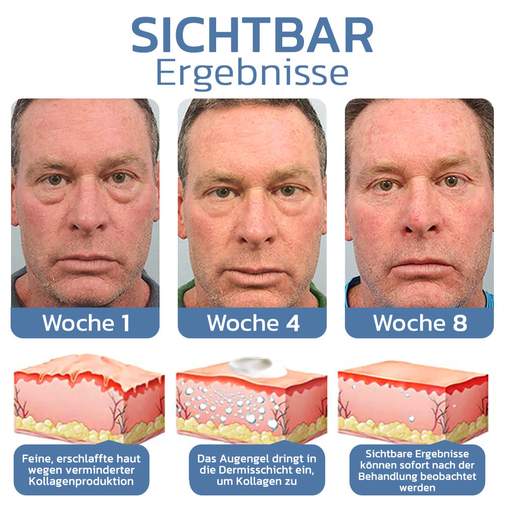 OPENEYES Erwecken Peptid Straffende Augengel