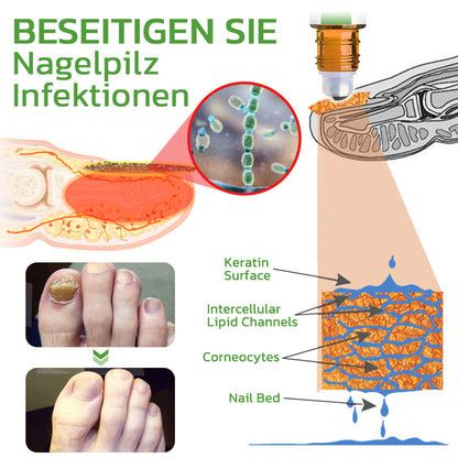 GFOUK™ 5 Tage Nagelwachstum und härtung Repair Roller