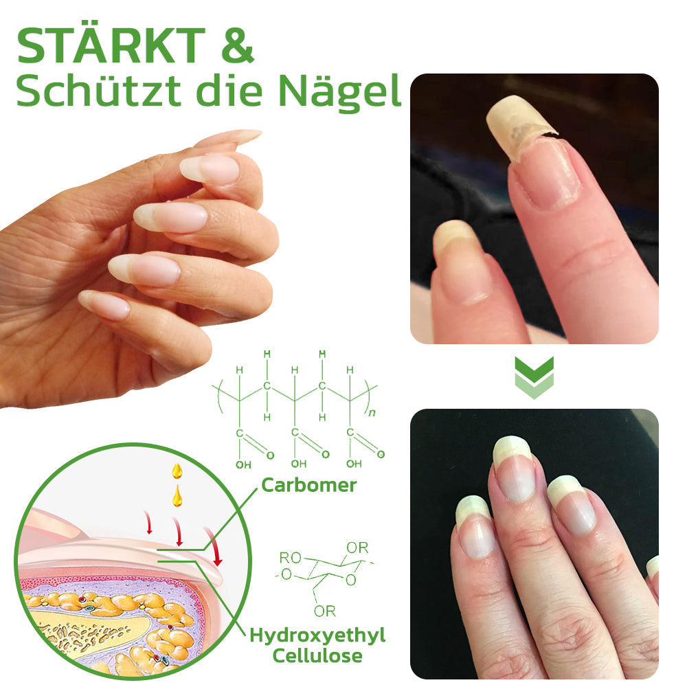 GFOUK™ 5 Tage Nagelwachstum und härtung Repair Roller