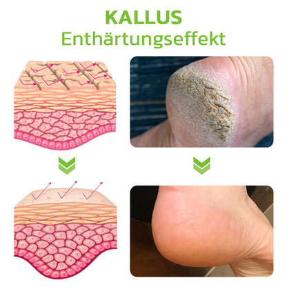 GFOUK™ IHerbal Fuß Schwielen und Hühneraugen Entfernung Soak