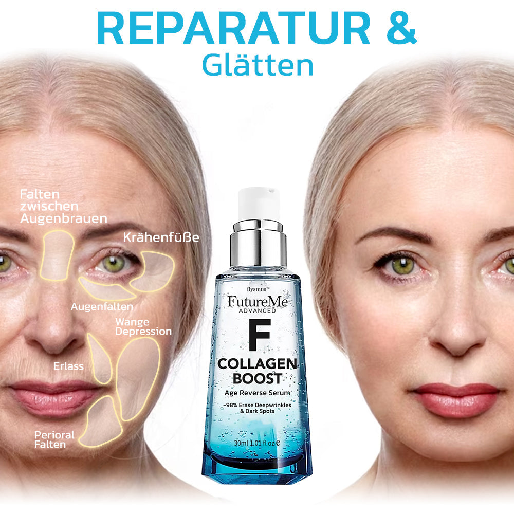 flysmus™ FutureMe Fortgeschrittene Kollagen Boost Alter Umkehren Serum