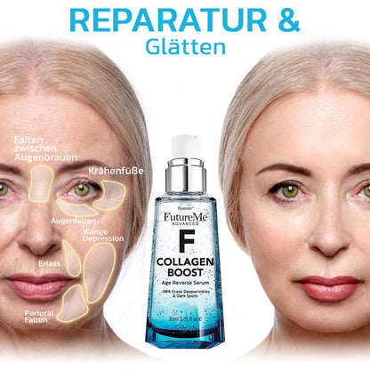 flysmus™ FutureMe Fortgeschrittene Kollagen Boost Alter Umkehren Serum