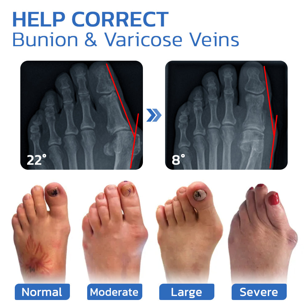 GFOUK™ AntiBunion und VeinHeal Gesundheitssocken