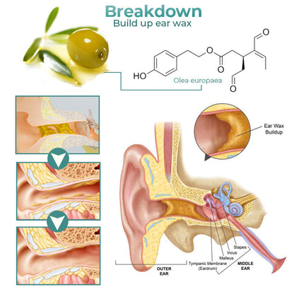 GFOUK™ Anti-Cochlea-Blockade-Entfernungsspray