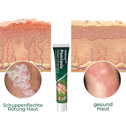 Kolmax™ Psoriasis lindernde Salbe