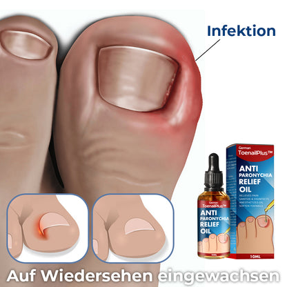 German ToenailPlus™ Anti Paronychia Hilfe Öl