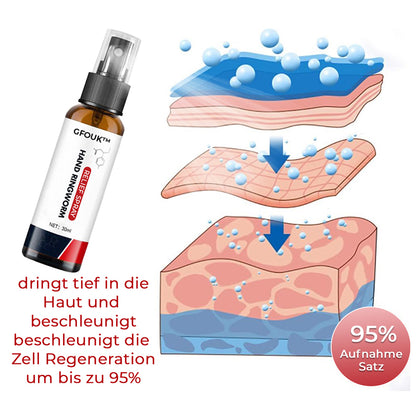 GFOUK™ Hand Ringelflechte Entlastung Spray